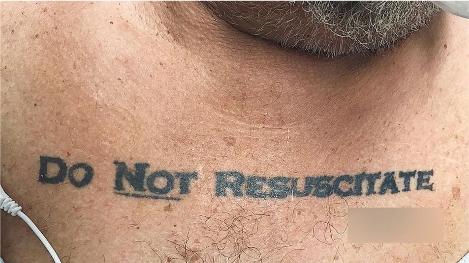 Image for Do-not-resuscitate tattoos: Will a doctor follow one?